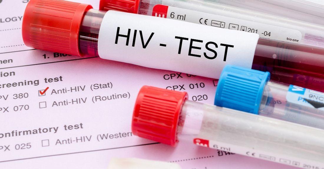 Братчане могут анонимно и бесплатно сдать кровь на ВИЧ-инфекцию 6 декабря