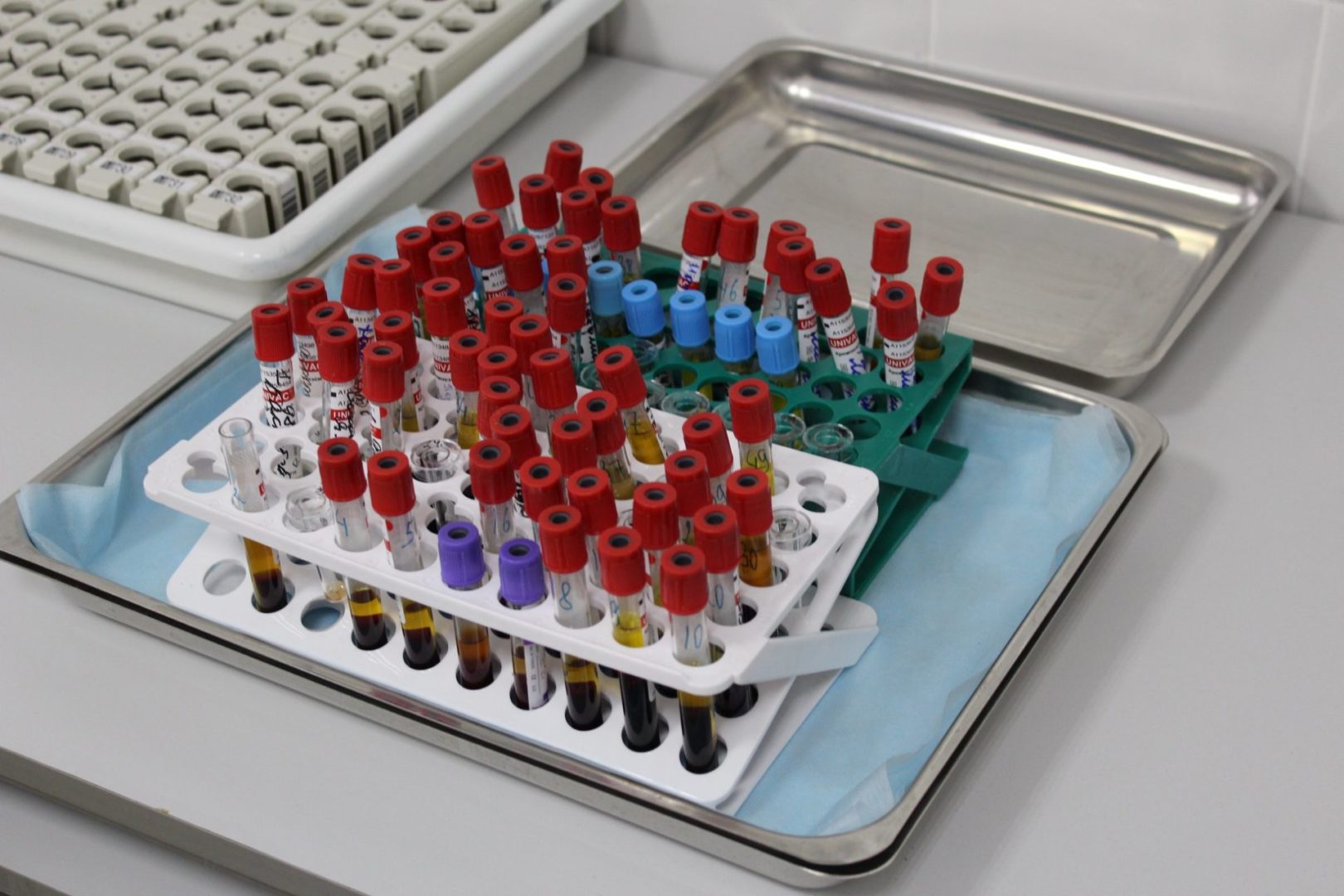 У семи человек в Иркутской области подтвержден коронавирус