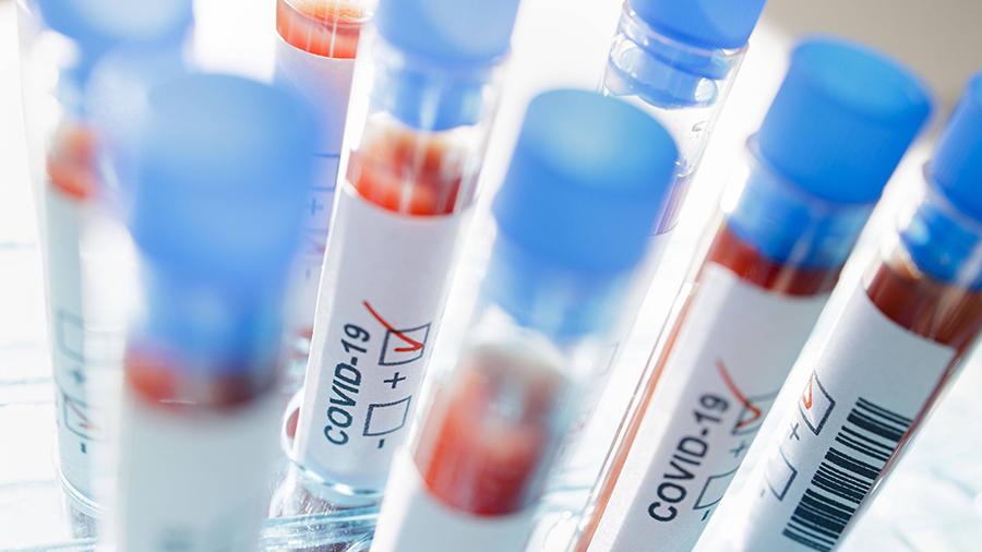 Более 53,3 тысяч исследований на COVID провели в Братске с середины мая